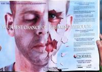 1993 Canadian Journal of Psychiatry Clozaril